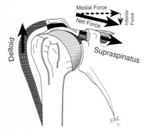 bad posture pictures